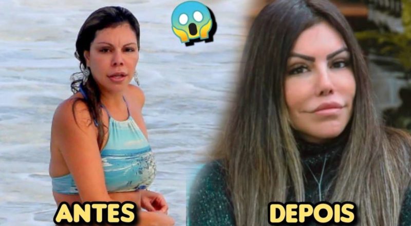 Liziane Gutierrez - antes e depois