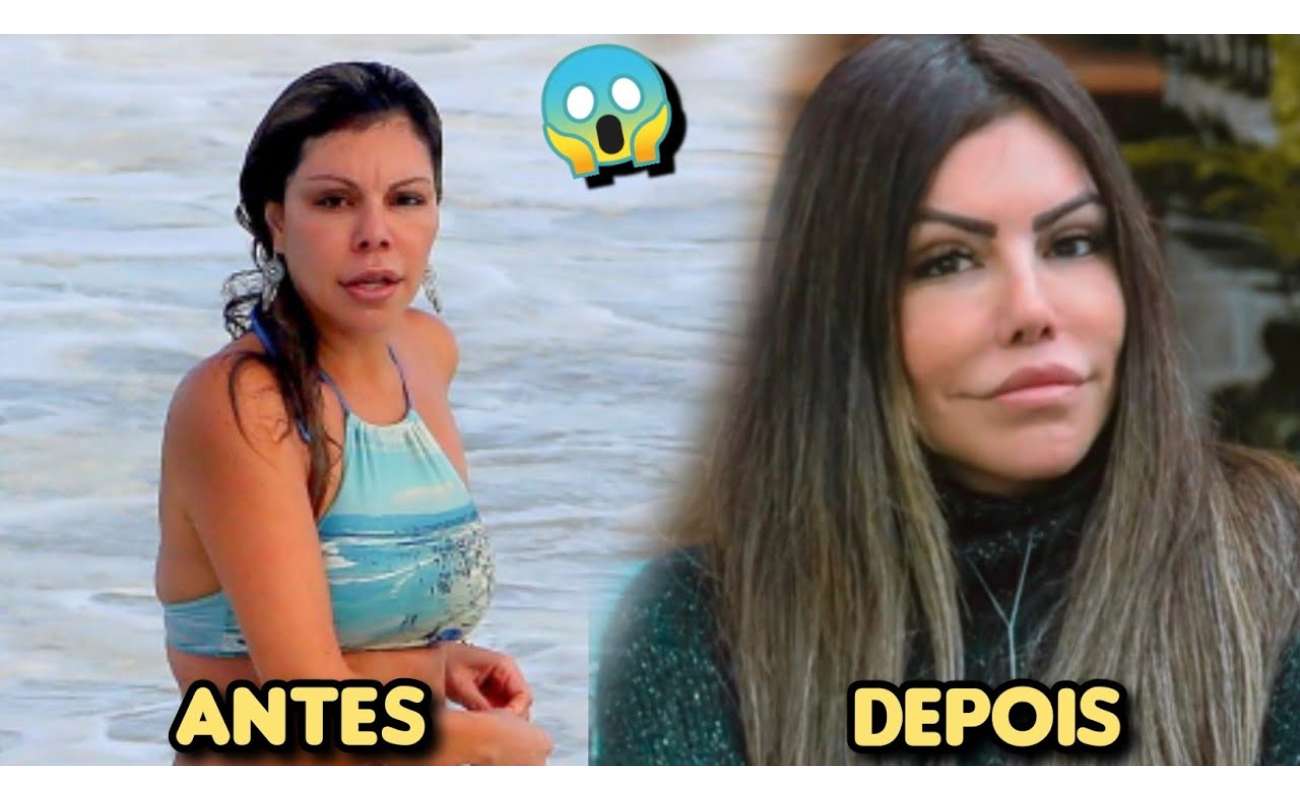 Liziane Gutierrez Antes E Depois Da Fama E Procedimentos Est Ticos