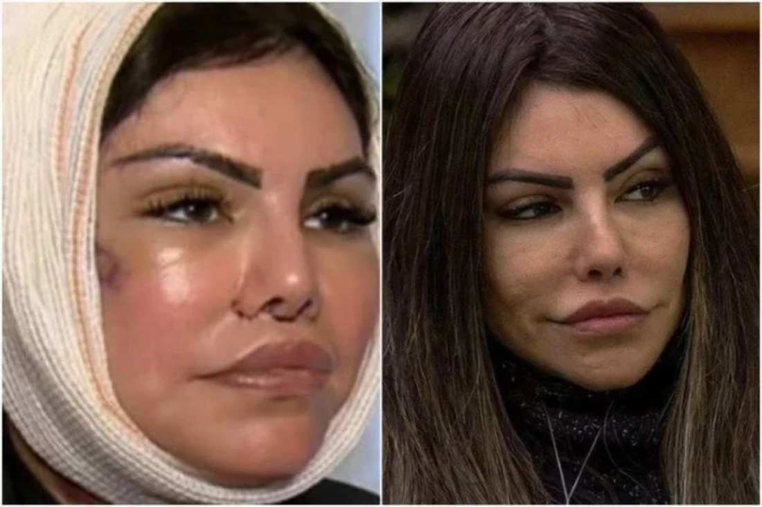 Liziane Gutierrez - antes e depois