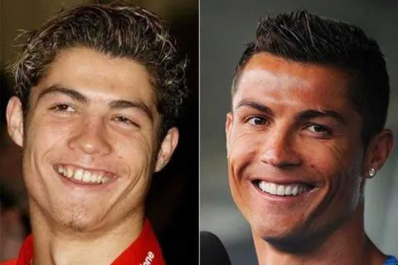 Cristiano Ronaldo antes e depois