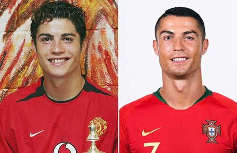 Cristiano Ronaldo antes e depois